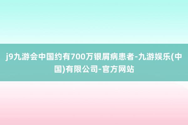 j9九游会中国约有700万银屑病患者-九游娱乐(中国)有限公司-官方网站